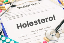 Photo of Zakaj je holesterol nevaren za zdravje?