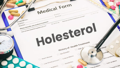 Photo of Zakaj je holesterol nevaren za zdravje?